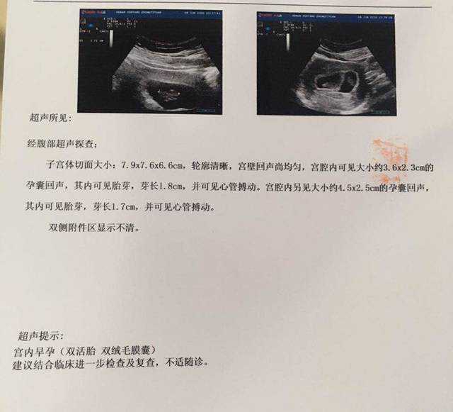 西安代生产子网，西安现代妇产医院早孕检查