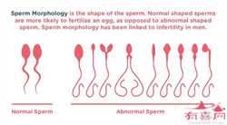 西安供卵官网~西安供卵助孕包成功~，为什么要在试管婴儿之前进行宫腔环境检
