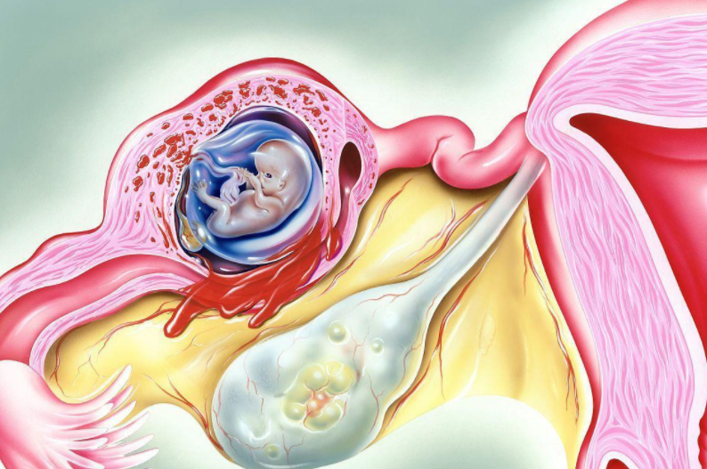 西安代怀孕案例，西安三代试管婴儿成功率和什么有关？