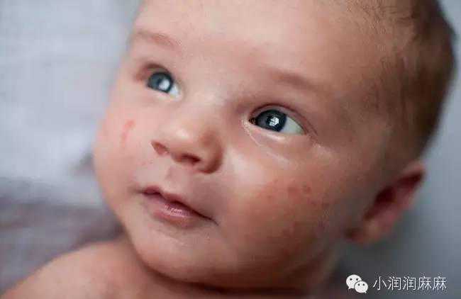 西安没有捐卵,西安捐卵包生男孩不可信，2022陕西10家试管医院供卵指南